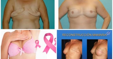 reconstrucción mamaria después de la masectomia