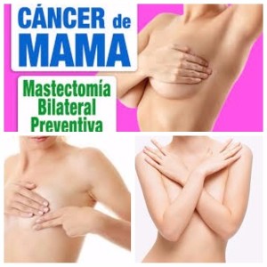 cancer de mama y reconstrucción
