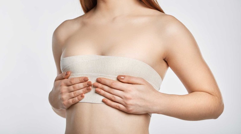 mujer tras una cirugía de senos, imagen representativa. Preguntas y respuestas sobre la cirugia de senos o mamoplastia